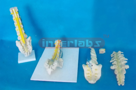 HUMAN CAUDA EQUINE AND ACANTHA NERVE IN LUMBAR AND SACRUM.